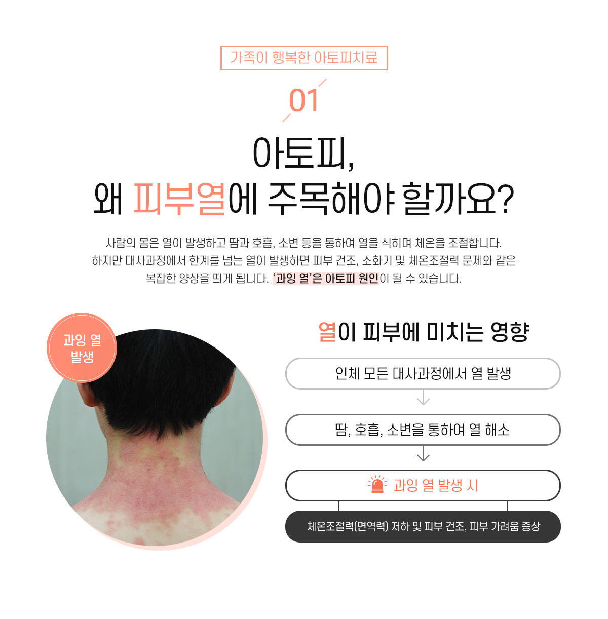 1. 아토피, 왜 피부열에 주목해야 할까요?