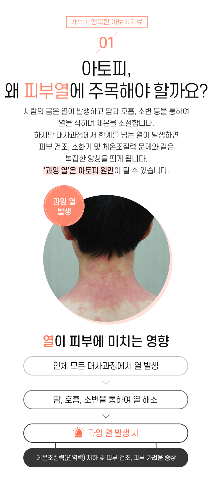 1. 아토피, 왜 피부열에 주목해야 할까요?