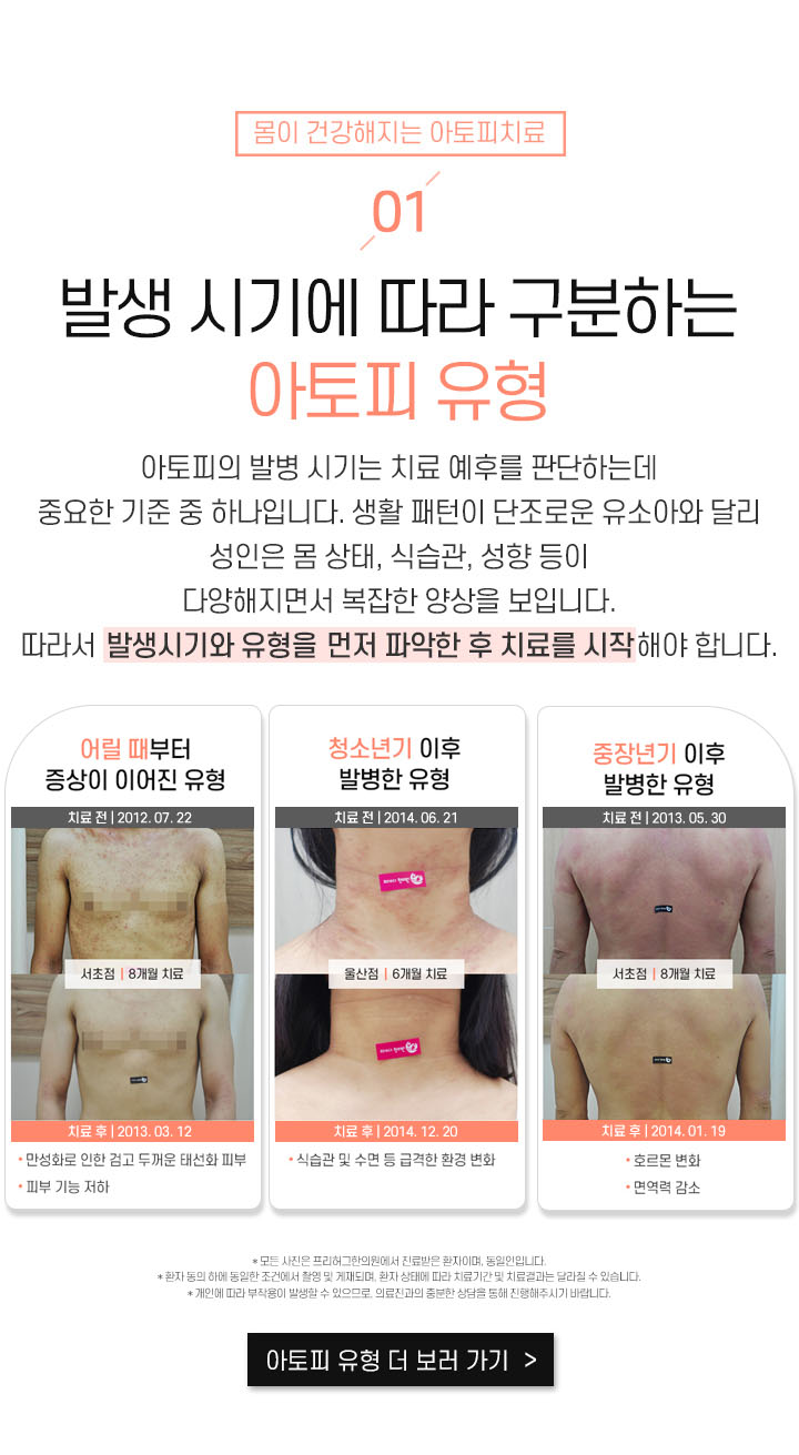 1. 발생 시기에 따라 구분하는 아토피 유형