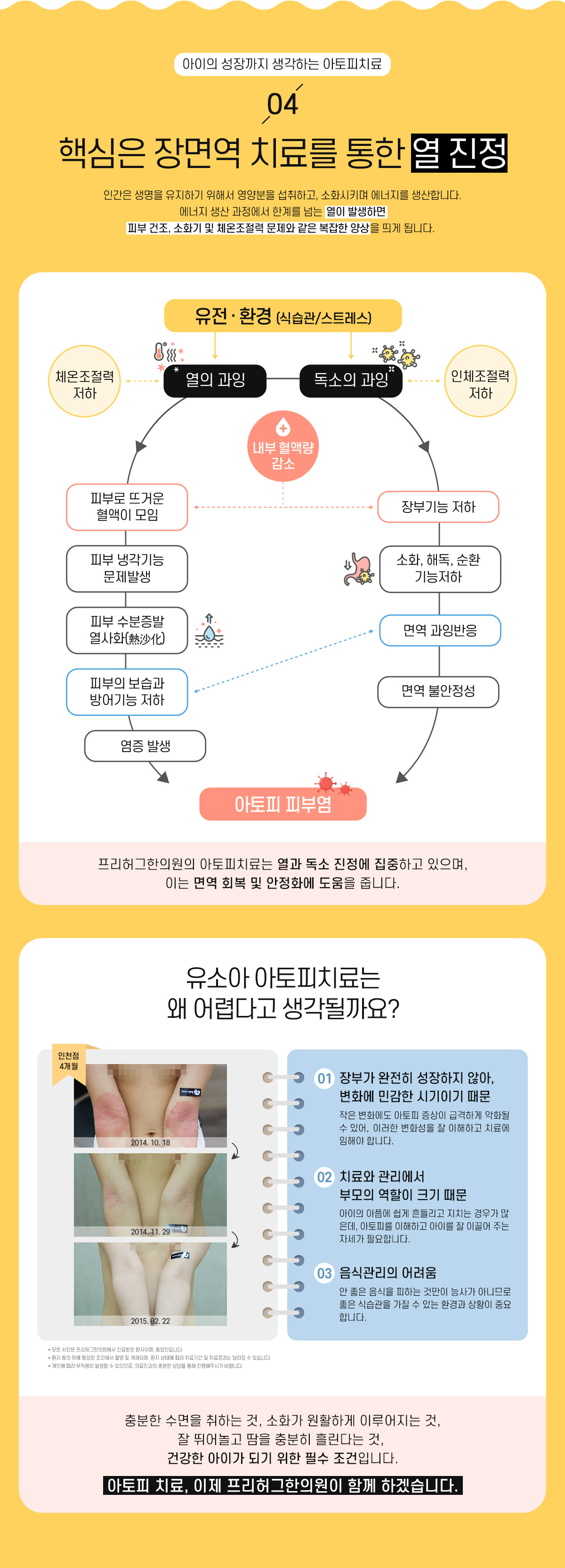 4. 핵심은 장면역 치료를 통한 열 진정 