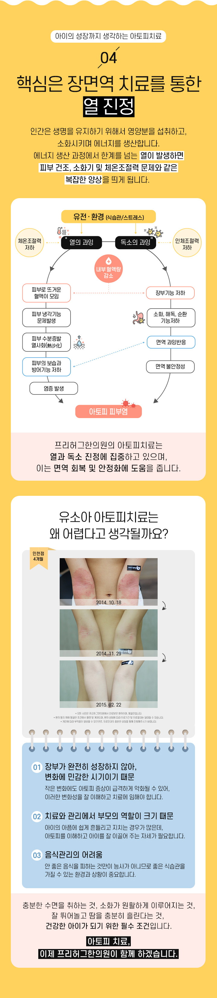 4. 핵심은 장면역 치료를 통한 열 진정 