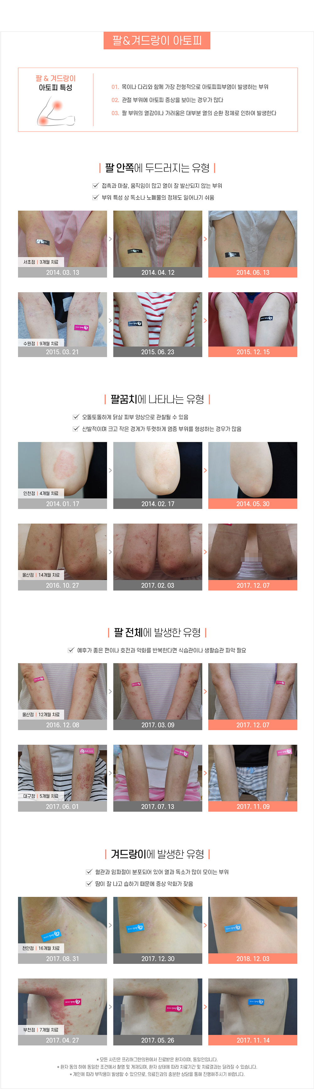 팔/겨드랑이 아토피