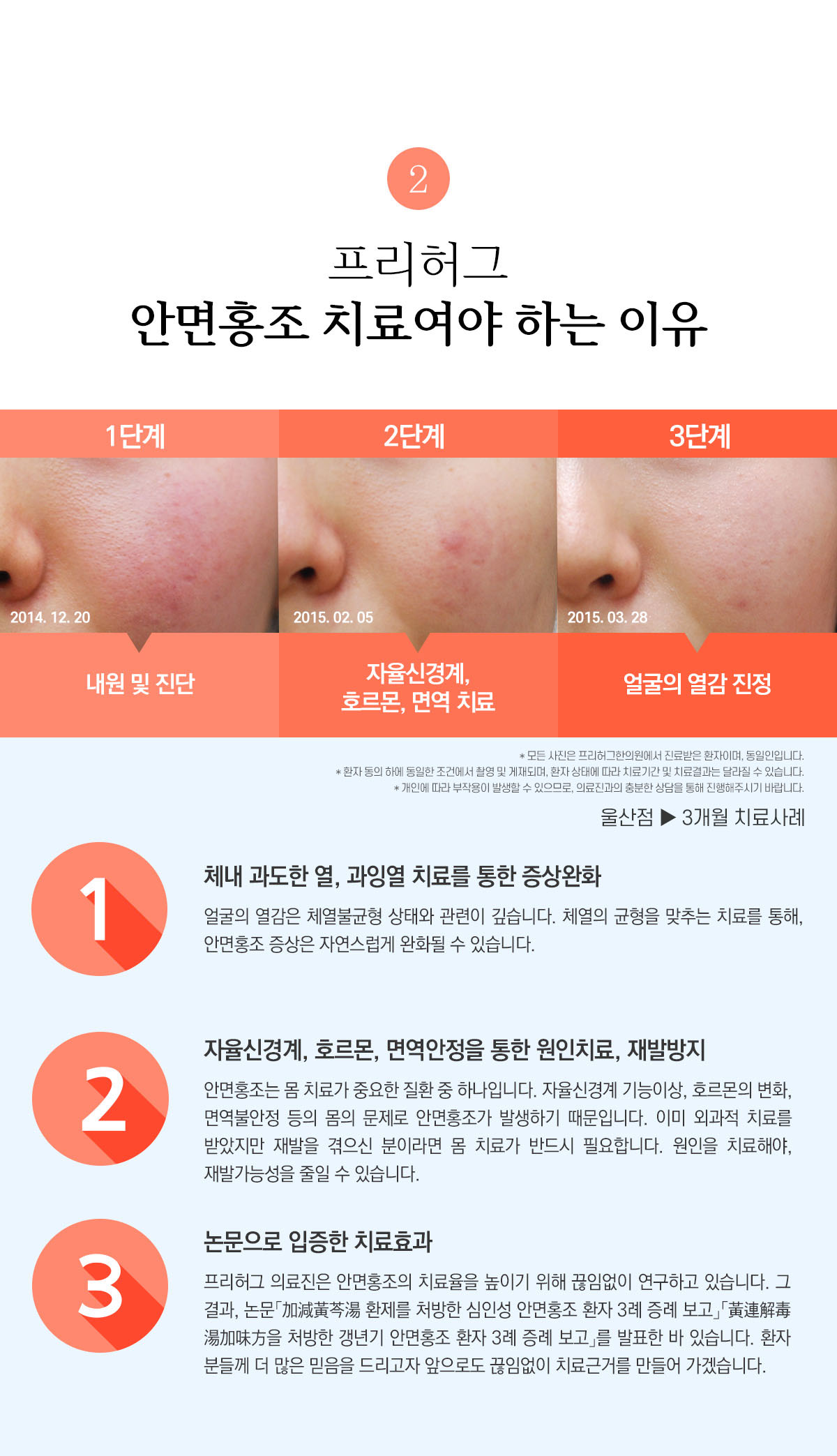 프리허그 안면홍조 치료여야 하는 이유