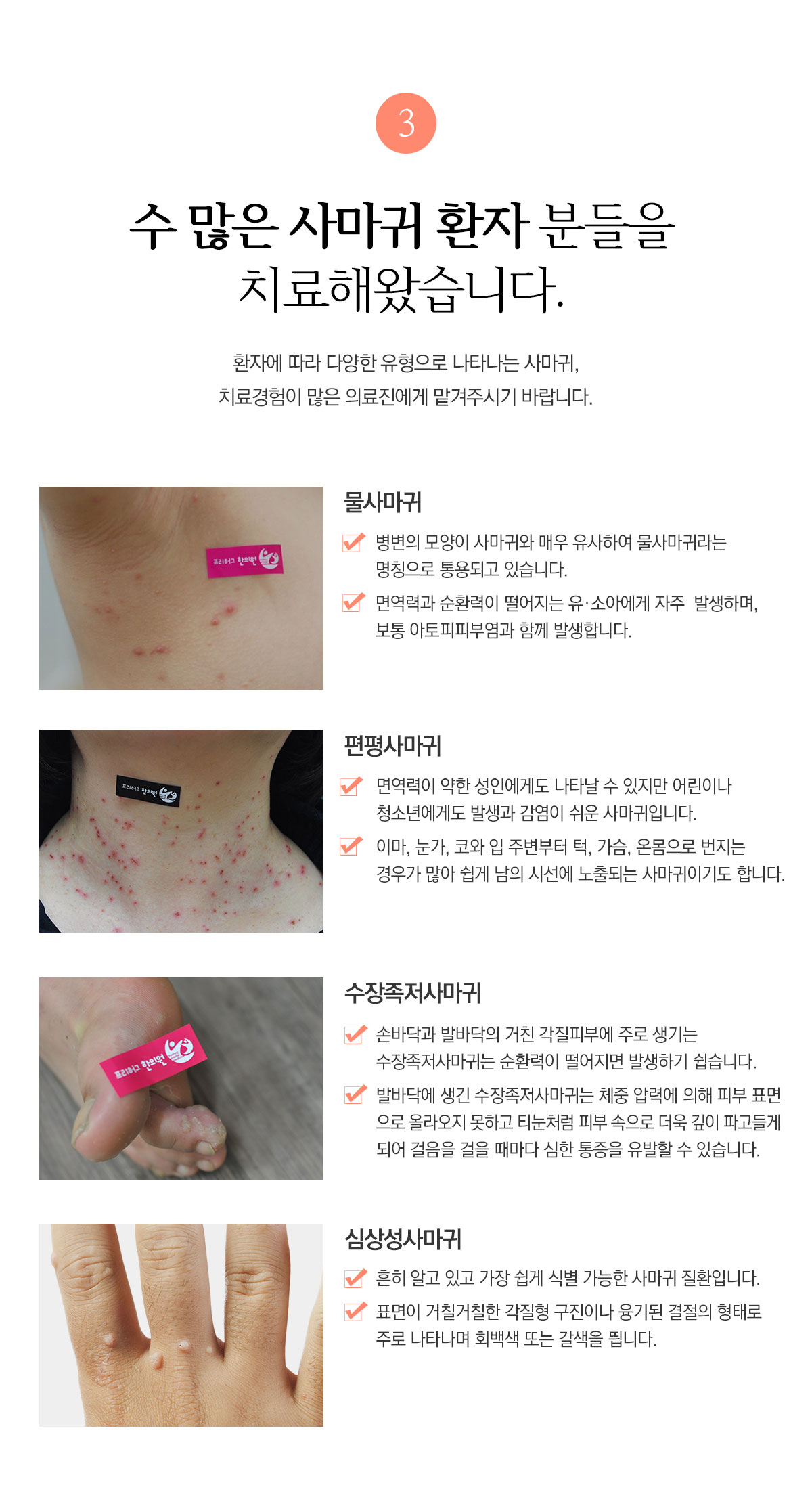 수 많은 사마귀 환자 분들을 치료해왔습니다